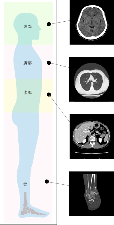 主な検査箇所（頭部、胸部、腹部、骨など）